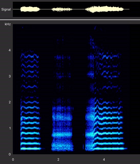 Vocal Fry Is A Vocal Register And An Effect Voice Manual